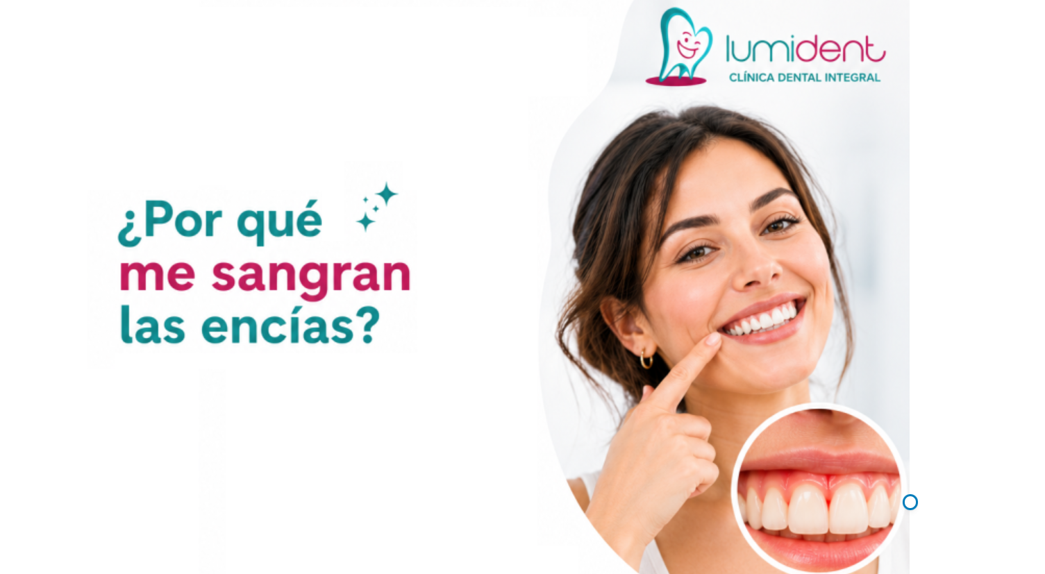 ¿Te sangran las encías? Descubre las causas y cómo solucionarlo.