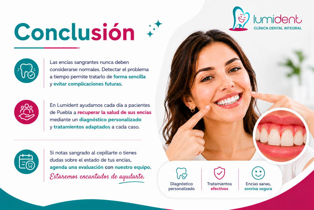 Conclusión del sangrado de encías. Sangrado de encías | Causas y como solucionar sangrado de encías