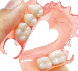 Puente-dental-sobre-implante Puente dental sobre implante en Clínica Dental San Manuel Puebla