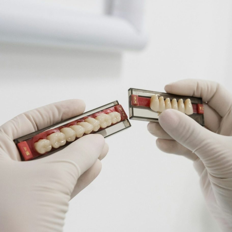 Estética dental Puebla | Lumident clínica dental | Dentistas Puebla