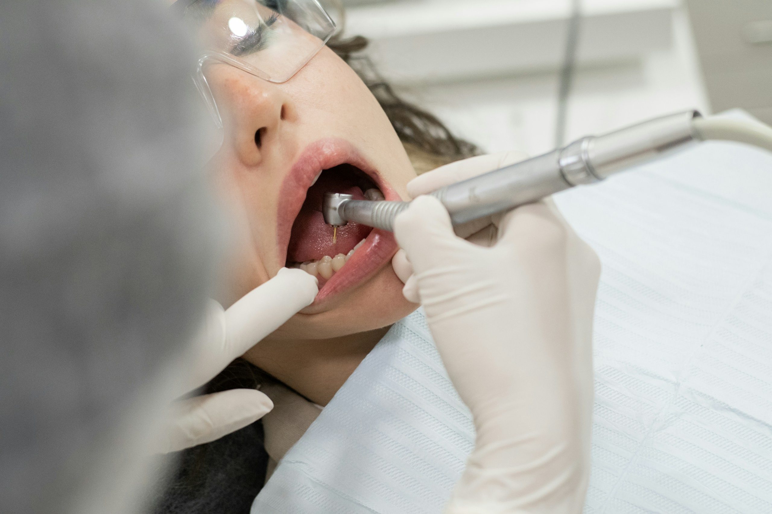 Cirugía dental en Puebla Cirujano dental en Puebla - Cirujano dental
